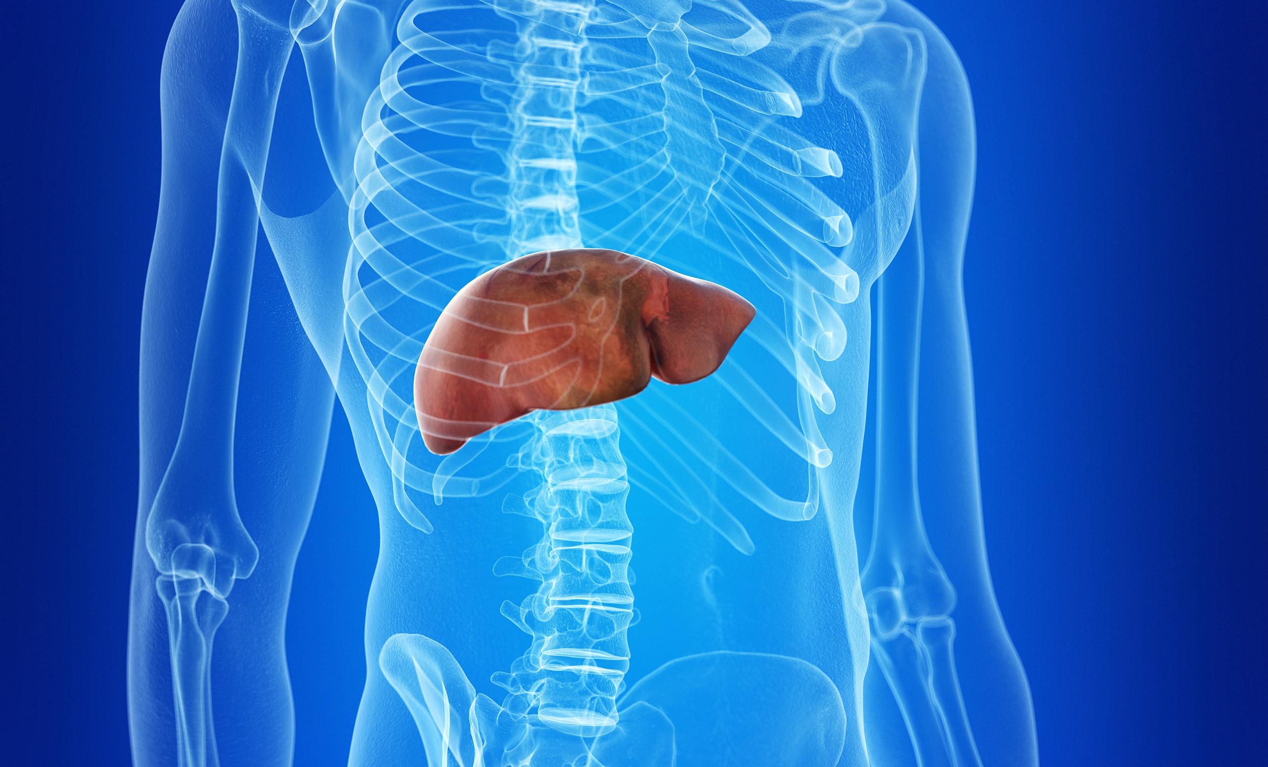 liver cancer